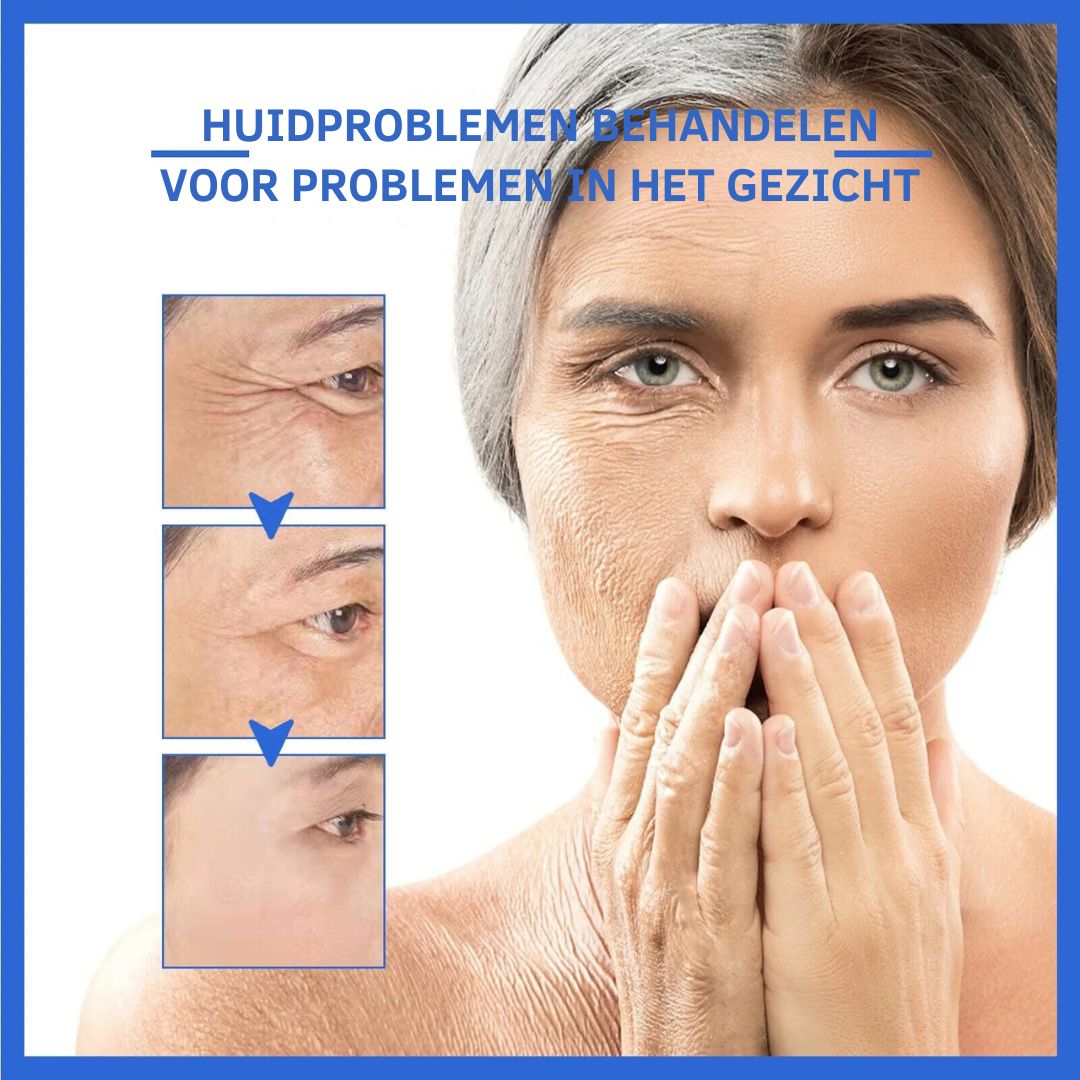 YouthBoost™ | Anti-verouderend Gezichtsserum (1+1 GRATIS)